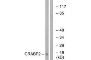 Western blot analysis of extracts from HT-29 cells, using CRABP2 Antibody. (CRABP2 抗体  (AA 41-90))