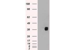 HEK293T cells were transfected with the pCMV6-ENTRY control (Left lane) or pCMV6-ENTRY CD2 (Right lane) cDNA for 48 hrs and lysed. (CD2 抗体)