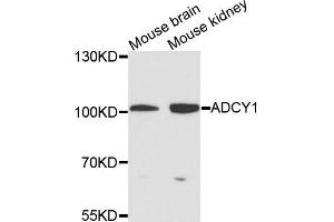 Western blot analysis of extracts of various cells, using ADCY1 antibody. (ADCY1 抗体)