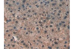 Detection of LIPG in Human Liver Tissue using Polyclonal Antibody to Lipase, Endothelial (LIPG) (LIPG 抗体  (AA 175-412))