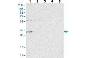 Western blot analysis of Lane 1: RT-4, Lane 2: U-251 MG, Lane 3: Human Plasma, Lane 4: Liver, Lane 5: Tonsil with ZFAND2B polyclonal antibody  at 1:250-1:500 dilution. (ZFAND2B 抗体)