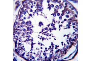 RAB5C antibody immunohistochemistry analysis in formalin fixed and paraffin embedded human testis tissue. (Rab5c 抗体  (AA 178-207))