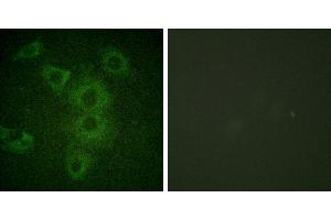 Peptide - +Immunofluorescence analysis of HuvEc cells, using BIK (Ab-33) antibody (#B0053). (BIK 抗体  (Thr33))