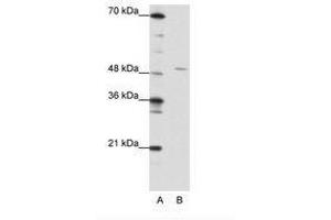 Image no. 1 for anti-High-Mobility Group 20A (HMG20A) (AA 181-230) antibody (ABIN202299) (HMG20A 抗体  (AA 181-230))