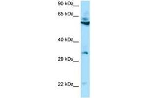 Image no. 1 for anti-Transmembrane Protein 192 (TMEM192) (AA 60-109) antibody (ABIN6748451) (TMEM192 抗体  (AA 60-109))