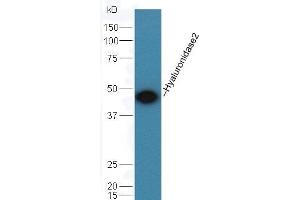 Mouse testis lysate probed with Rabbit Anti-Hyaluronidase 2 Polyclonal Antibody (ABIN759371) at 1:300 overnight in 4 °C. (HYAL2 抗体  (AA 111-210))