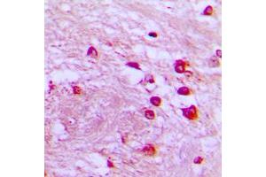 Immunohistochemical analysis of p39 staining in human brain formalin fixed paraffin embedded tissue section. (p39 (Center) 抗体)