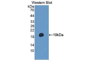 Western blot analysis of the recombinant protein. (TSC22D3 抗体  (AA 1-137))