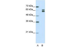 MSH2 antibody used at 1. (MSH2 抗体)