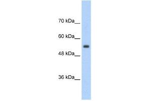 WB Suggested Anti-SLC13A3 Antibody Titration:  2. (SLC13A3 抗体  (Middle Region))