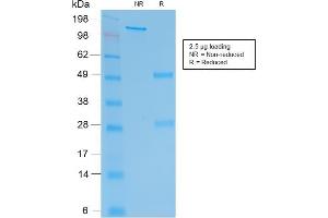 SDS-PAGE Analysis Purified hCG beta Mouse Recombinant Monoclonal Antibody (rHCGb/54). (Recombinant CGB 抗体)