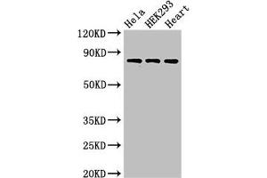 Western Blot Positive WB detected in: Hela whole cell lysate, HEK293 whole cell lysate, Rat heart tissue All lanes: C1R antibody at 3 μg/mL Secondary Goat polyclonal to rabbit IgG at 1/50000 dilution Predicted band size: 81 kDa Observed band size: 81 kDa (C1R 抗体  (AA 65-192))