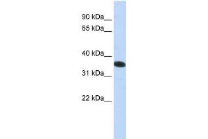 WB Suggested Anti-C21orf59  Antibody Titration: 0. (C21orf59 抗体  (N-Term))