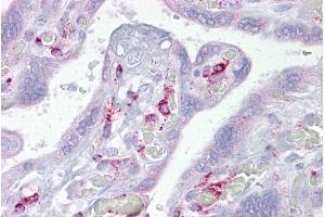 Immunohistochemistry with Placenta tissue at an antibody concentration of 5µg/ml using anti-ING3 antibody (ARP33346_P050) (ING3 抗体  (N-Term))
