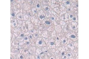 Figure. (Integrin beta 4 抗体  (AA 923-1197))