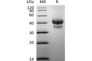 Western Blotting (WB) image for Tumor Necrosis Factor Receptor Superfamily, Member 17 (TNFRSF17) protein (Biotin) (ABIN7319772)