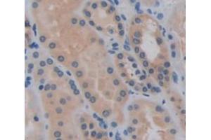 IHC-P analysis of Human Tissue, with DAB staining. (LCN12 抗体  (AA 61-184))
