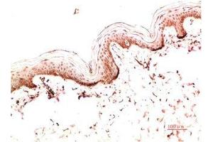 Immunohistochemistry (IHC) image for anti-Collagen, Type I, alpha 1 (COL1A1) antibody (ABIN7189550)