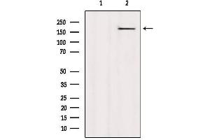 Western blot analysis of extracts from HepG2, using CAMSAP2 Antibody. (CAMSAP2 抗体  (C-Term))