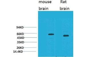 Western Blot (WB) analysis of 1) Mouse Brain Tissue, 2)Rat Brain Tissue with EAAT2 Rabbit Polyclonal Antibody diluted at 1:2000. (SLC1A2 抗体)