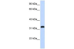 C21ORF62 antibody used at 1 ug/ml to detect target protein. (C21orf62 抗体  (Middle Region))