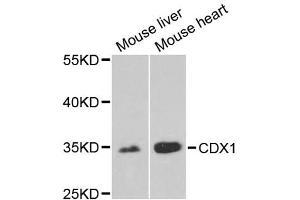 Western blot analysis of extracts of various cell lines, using CDX1 antibody (ABIN2561793) at 1:1000 dilution. (CDX1 抗体)