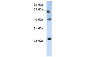 Tetraspanin 3 antibody used at 1 ug/ml to detect target protein. (Tetraspanin 3 抗体  (Middle Region))