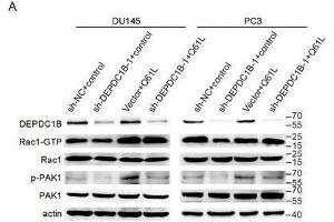 Mutated active Rac1 plasmid (Q61L) recuses the function in DEPDC1B-knockdown cells. (PAK1 抗体  (AA 1-240))
