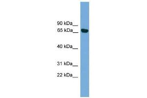 Western Blot showing PRKCI antibody used at a concentration of 1-2 ug/ml to detect its target protein. (PKC iota 抗体  (Middle Region))