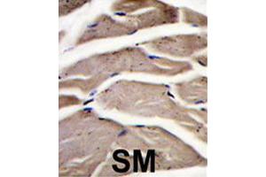 Formalin-fixed and paraffin-embedded human skeletal muscle reacted with PFKM polyclonal antibody  , which was peroxidase-conjugated to the secondary antibody, followed by DAB staining. (PFKM 抗体  (C-Term))
