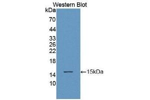 Detection of Recombinant ACYP1, Human using Polyclonal Antibody to Acylphosphatase 1, Erythrocyte (ACYP1) (Acylphosphatase 1, Erythrocyte (AA 1-99) 抗体)