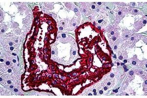 Human Kidney: Formalin-Fixed, Paraffin-Embedded (FFPE) (Inhibin alpha 抗体)