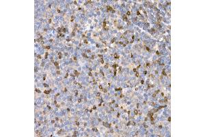 Immunohistochemistry of paraffin-embedded human tonsil using LTBR Rabbit pAb (ABIN6129412, ABIN6143379, ABIN6143381 and ABIN6220987) at dilution of 1:25 (40x lens). (LTBR 抗体  (AA 31-227))
