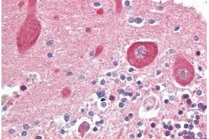 Human Brain, Cerebellum (formalin-fixed, paraffin-embedded) stained with MAP2K1 antibody ABIN461964 at 10 ug/ml followed by biotinylated goat anti-rabbit IgG secondary antibody ABIN481713, alkaline phosphatase-streptavidin and chromogen. (MEK1 抗体  (N-Term))