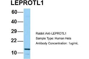 Host: Rabbit Target Name: LEPROTL1 Sample Type: Human Hela Antibody Dilution: 1. (LEPROTL1 抗体  (N-Term))