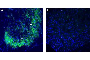 Expression of P2RY1 in rat spinal cord. (Purinergic Receptor P2Y, G-Protein Coupled, 1 (P2RY1) Peptide)