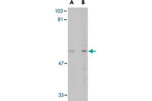 Western blot analysis of LGI4 in rat brain tissue lysate with LGI4 polyclonal antibody  at (A) 1 and (B) 2 ug/mL . (LGI4 抗体  (C-Term))