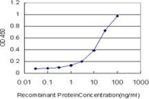 Detection limit for recombinant GST tagged HDAC8 is approximately 0. (HDAC8 抗体  (AA 1-377))