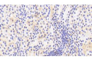 Detection of APPBP1 in Human Kidney Tissue using Polyclonal Antibody to Amyloid Beta Precursor Protein Binding Protein 1 (APPBP1) (NAE1 抗体  (AA 229-534))