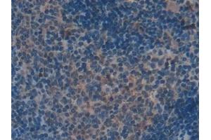 Detection of CXCL7 in Mouse Spleen Tissue using Polyclonal Antibody to Chemokine (C-X-C motif) ligand 7 ( CXCL7) (CXCL7 抗体  (AA 40-113))