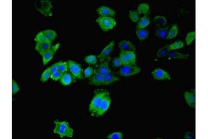 Immunofluorescence staining of HepG2 cells with ABIN7142083 at 1:200, counter-stained with DAPI. (YWHAB 抗体  (AA 1-246))