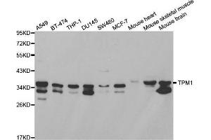 Western blot analysis of extracts of various cell lines, using TPM1 antibody. (Tropomyosin 抗体  (AA 1-245))