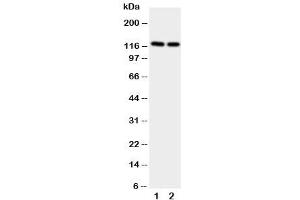 Western blot testing of NRP2 antibody and Lane 1:  rat brain (NRP2 抗体  (AA 45-60))