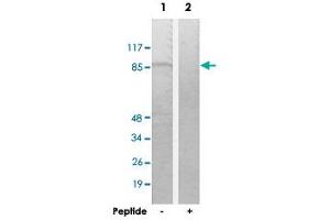 Western blot analysis of extracts from K-562 cells, using TACC1 polyclonal antibody . (TACC1 抗体  (N-Term))