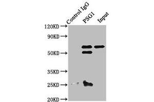 Immunoprecipitating PSG1 in A549 whole cell lysate Lane 1: Rabbit control IgG instead of ABIN7164230 in A549 whole cell lysate. (PSG1 抗体  (AA 180-419))