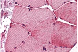 Human Skeletal Muscle: Formalin-Fixed, Paraffin-Embedded (FFPE) (Fukutin 抗体  (AA 272-456))