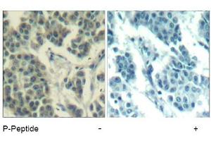 Image no. 3 for anti-Receptor Tyrosine-Protein Kinase ErbB-3 (ERBB3) (pTyr1328) antibody (ABIN319274) (ERBB3 抗体  (pTyr1328))