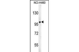 ST18 Antibody (N-term) (ABIN651571 and ABIN2840307) western blot analysis in NCI- cell line lysates (35 μg/lane). (ST18 抗体  (N-Term))