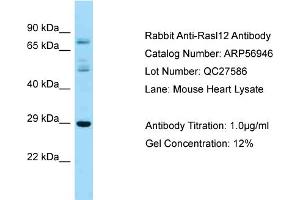 Western Blotting (WB) image for anti-RAS-Like, Family 12 (RASL12) (N-Term) antibody (ABIN2786986) (RASL12 抗体  (N-Term))