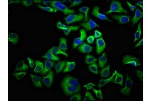 Immunofluorescence staining of Hela cells with ABIN7161187 at 1:100, counter-stained with DAPI. (UNC5D 抗体  (AA 90-212))
